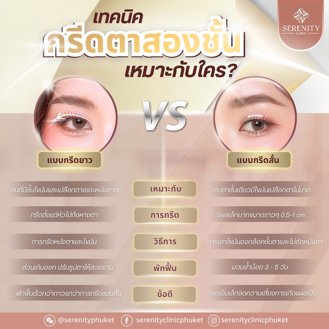 เปรียบเทียบเทคนิคกรีดตาสองชั้นแบบกรีดยาวกับแบบกรีดสั้น ว่าเหมาะกับใครและต่างกันอย่างไร