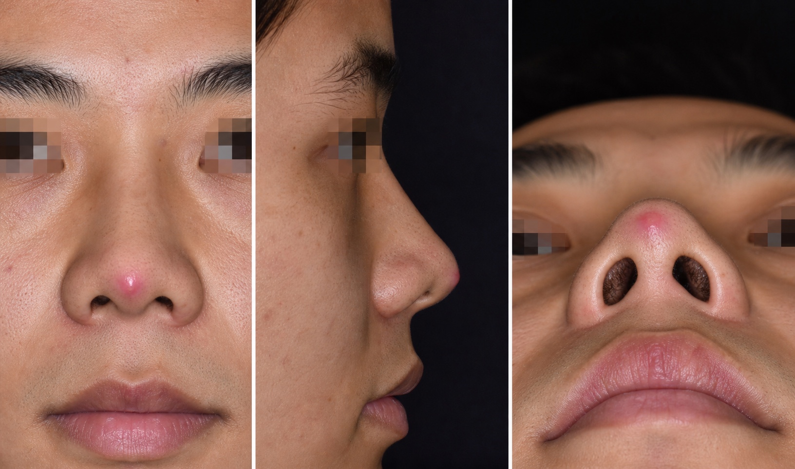 ภาพจำลอง AI แสดงสัญญาณวัสดุใกล้โผล่ผ่านผิวปลายจมูก