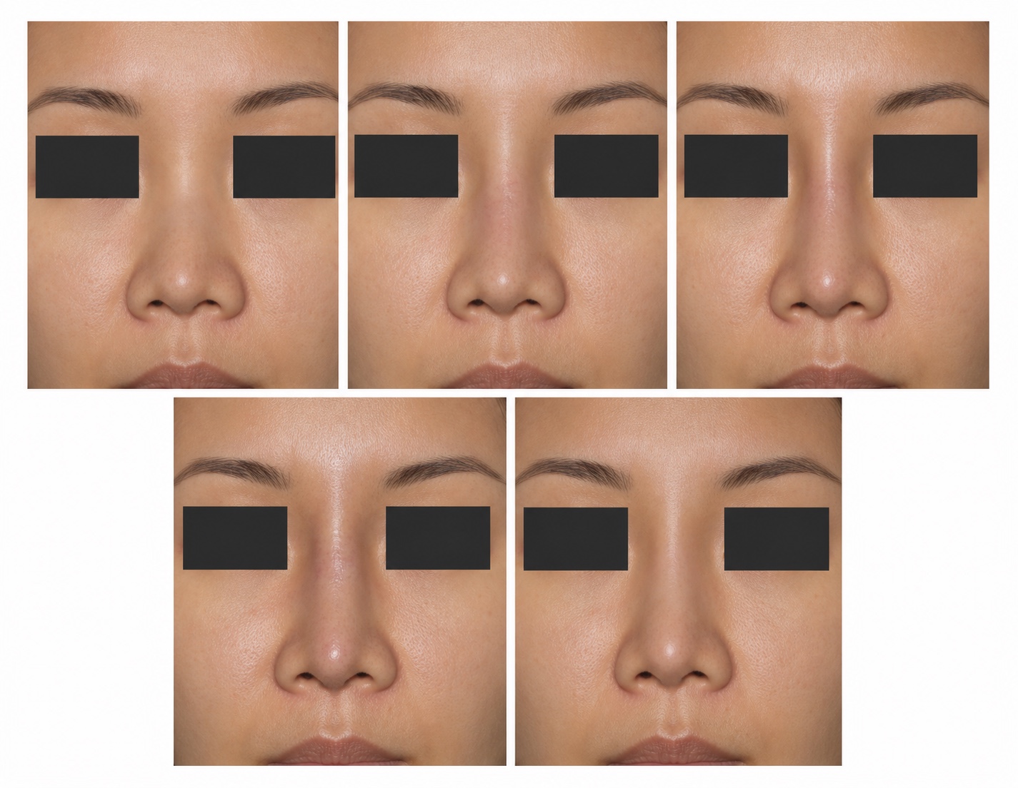 ภาพจำลอง AI แสดงแนวสันจมูกจากขอบวัสดุและความสูงที่ต่างกัน