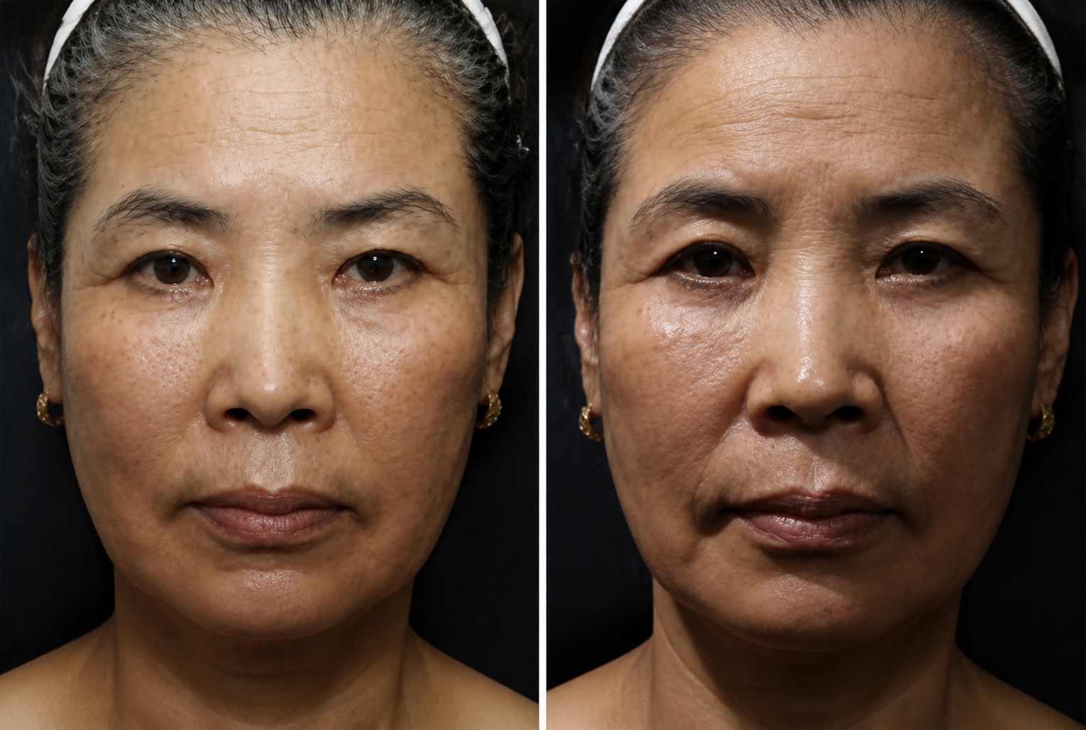 ภาพจำลอง AI เปรียบเทียบทิศทางแสงตรงและแสงเฉียง