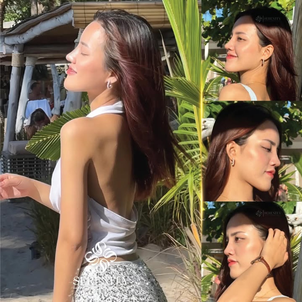 ภาพรีวิวทรงจมูกหลังเสริมจากผู้ใช้บริการ